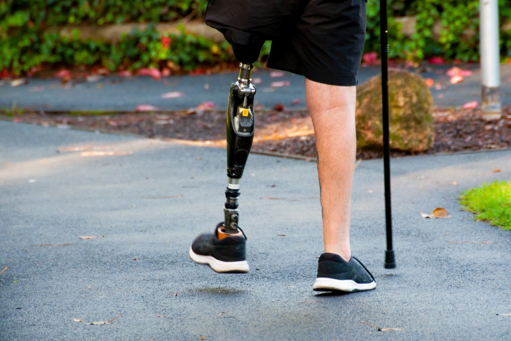 Bionic leg breakthrough: mind-controlled prosthetics transform mobility for amputees