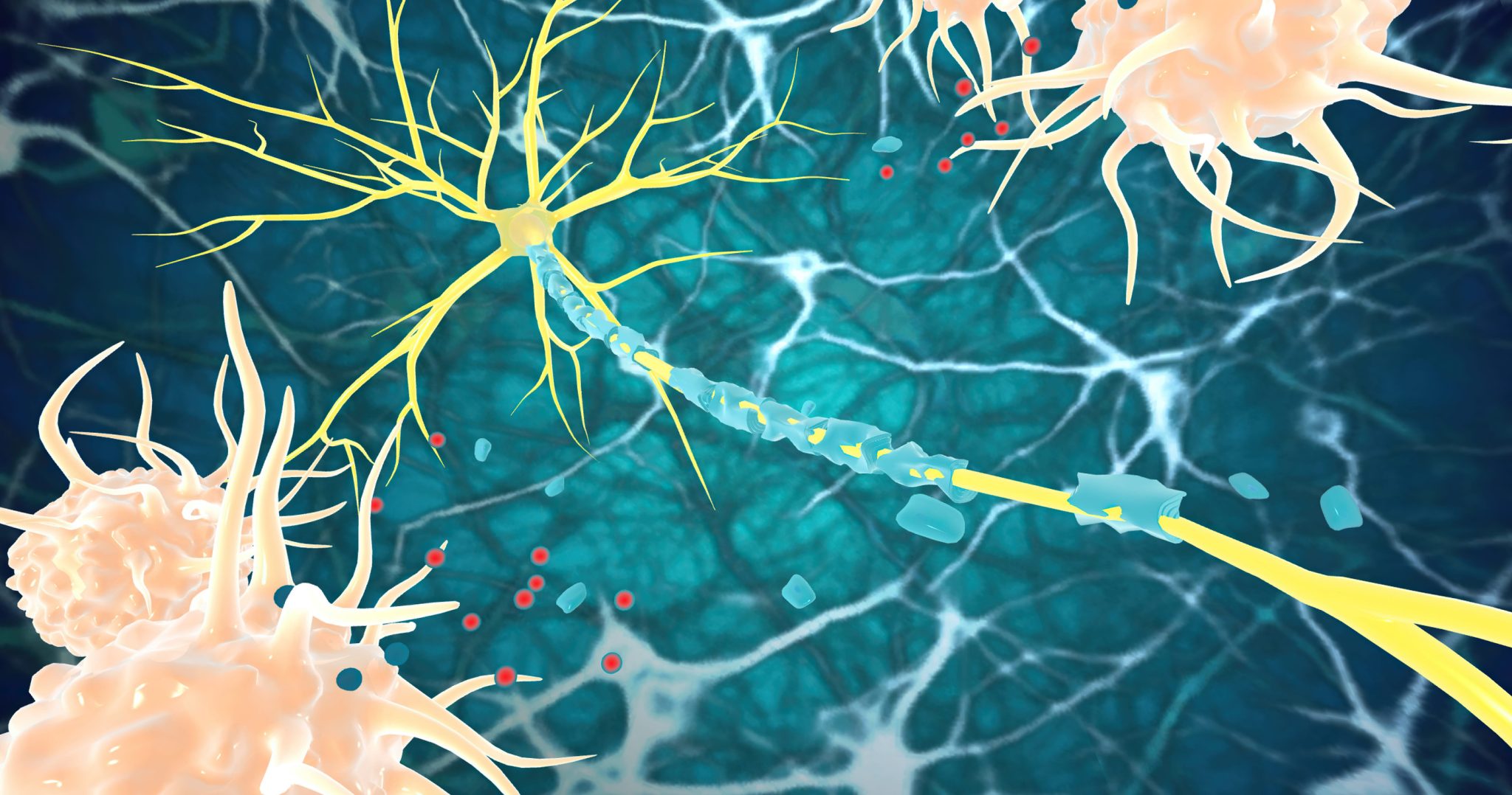 Three colorful neurons with yellow branching dendrites and a blue myelinated axon within a neural network.