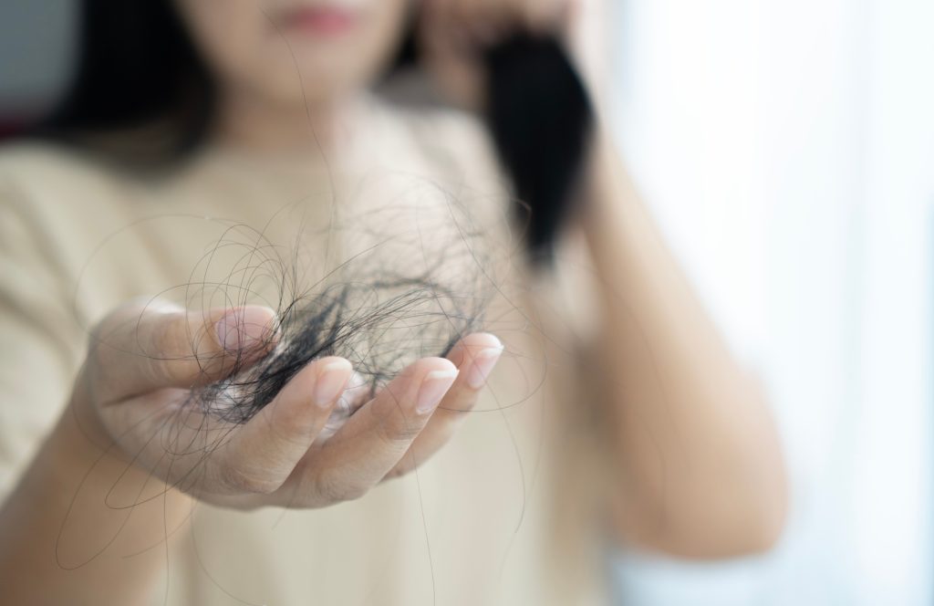 Natural ways to fight hair loss: 6 foods that block DHT