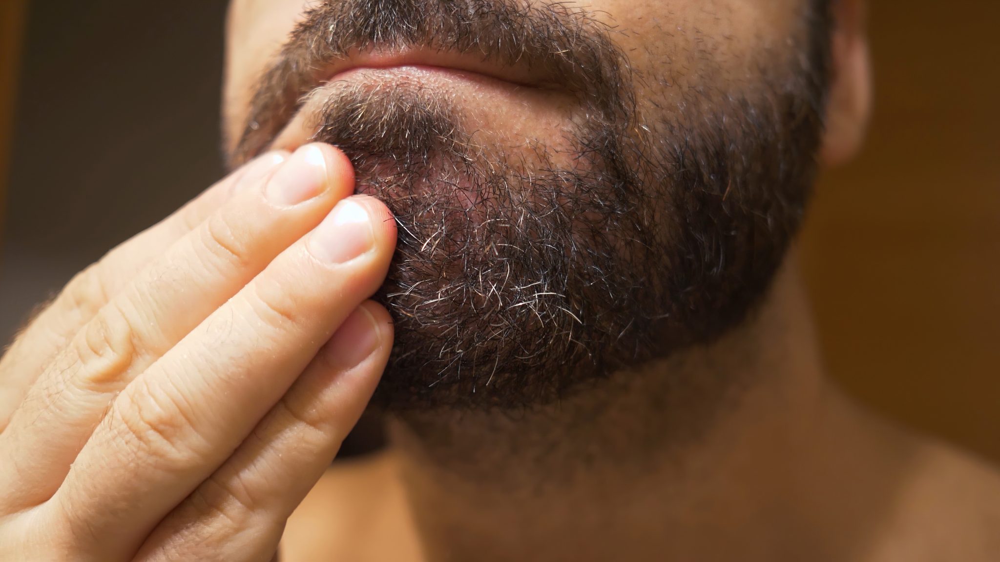 Close-up of a man's beard with visible skin flaking, illustrating common beard dandruff symptoms