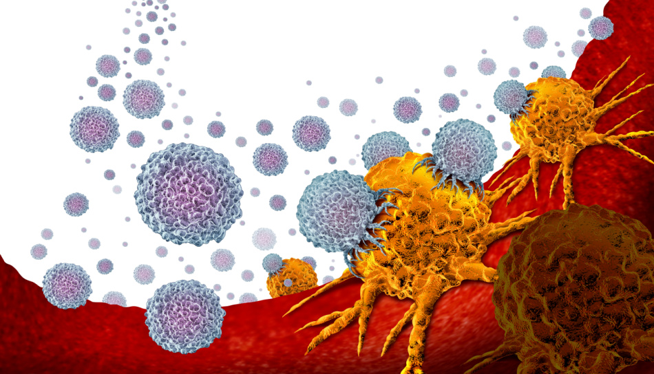 Oncology medicine and cancer treatment concept as a tumor or tumour being treated with white blood cells attacking the disease as an immunotherapy 3D illustration.