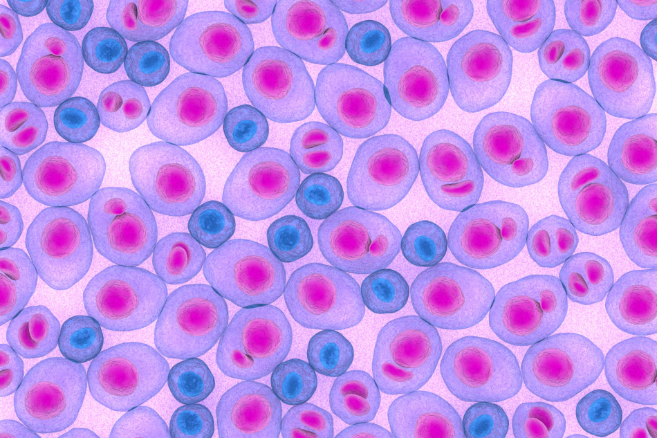 Myeloma multiplex leukemia cancer 3d color render illustration