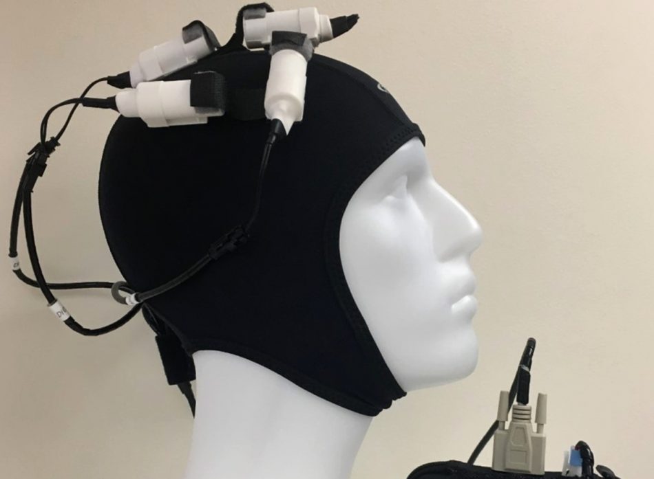 This device might help stroke 