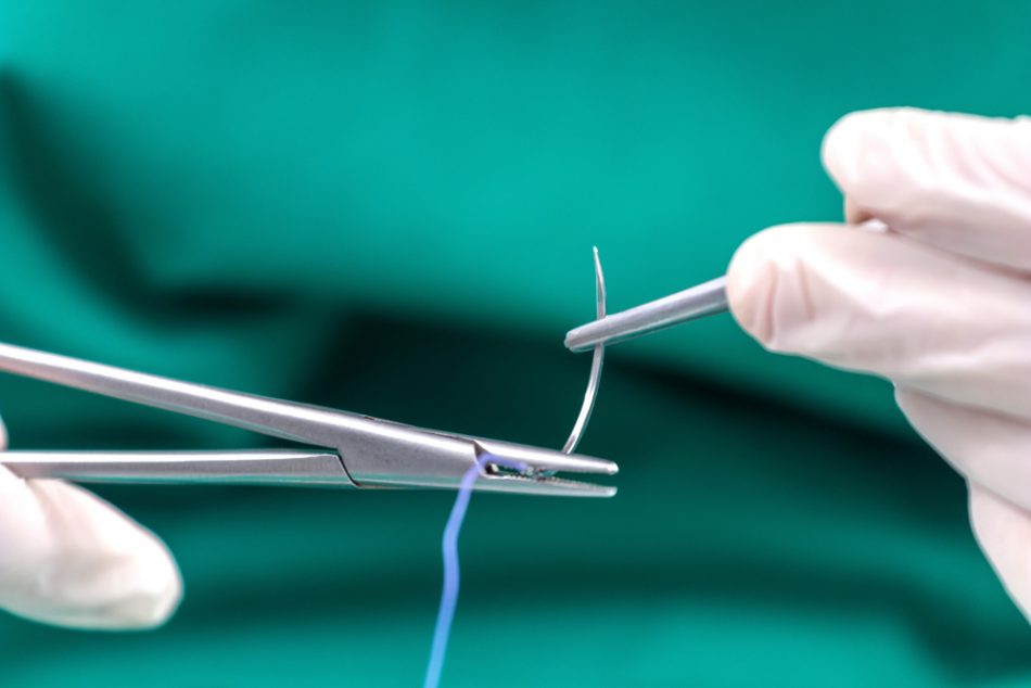 Advanced suture design mimics 