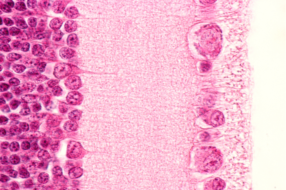 High magnification micrograph showing the inner layers of retina.