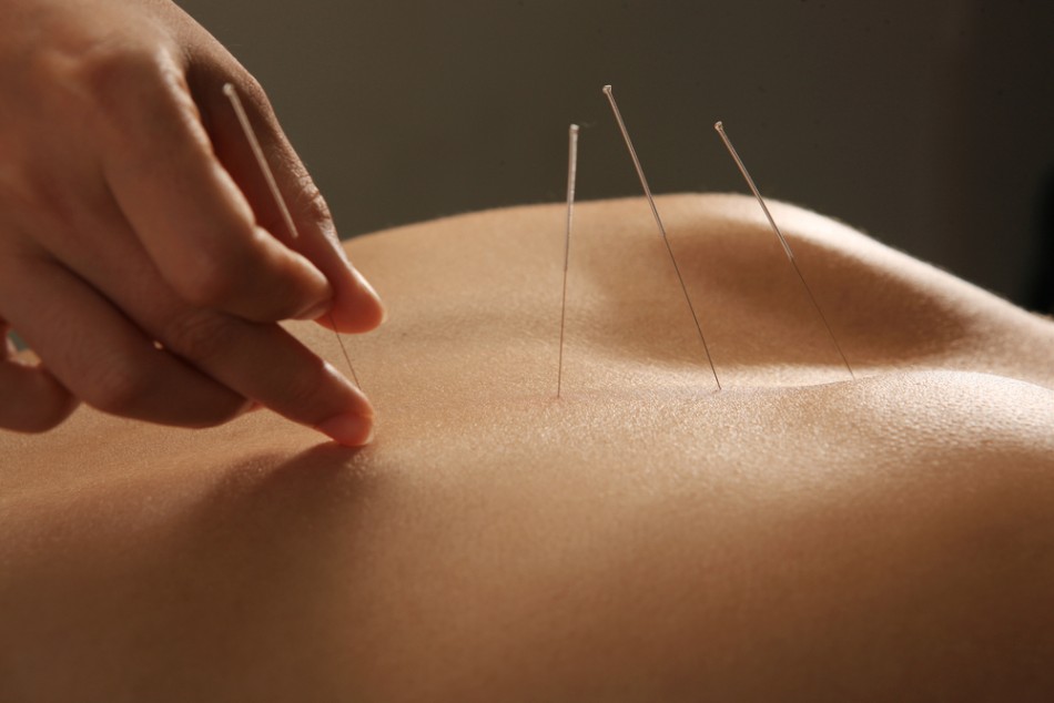 How acupuncture can help to re
