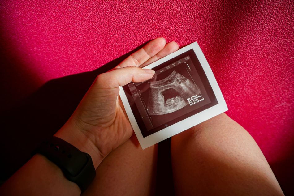 Woman holding ultrasound image