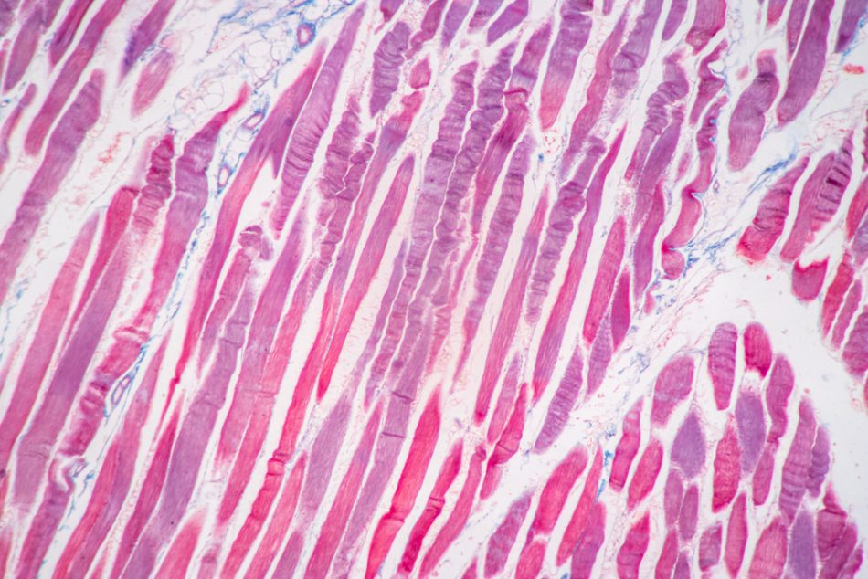 Mammal muscle tissue.