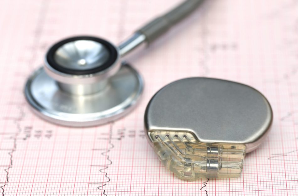 Close up of electrocardiograph with stethoscope and pacemaker.