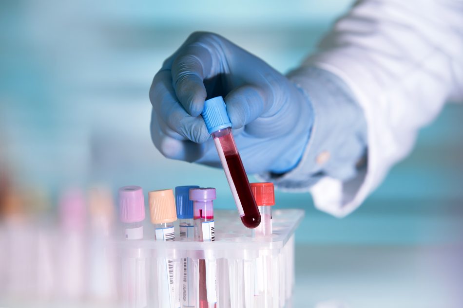 New blood test could provide e