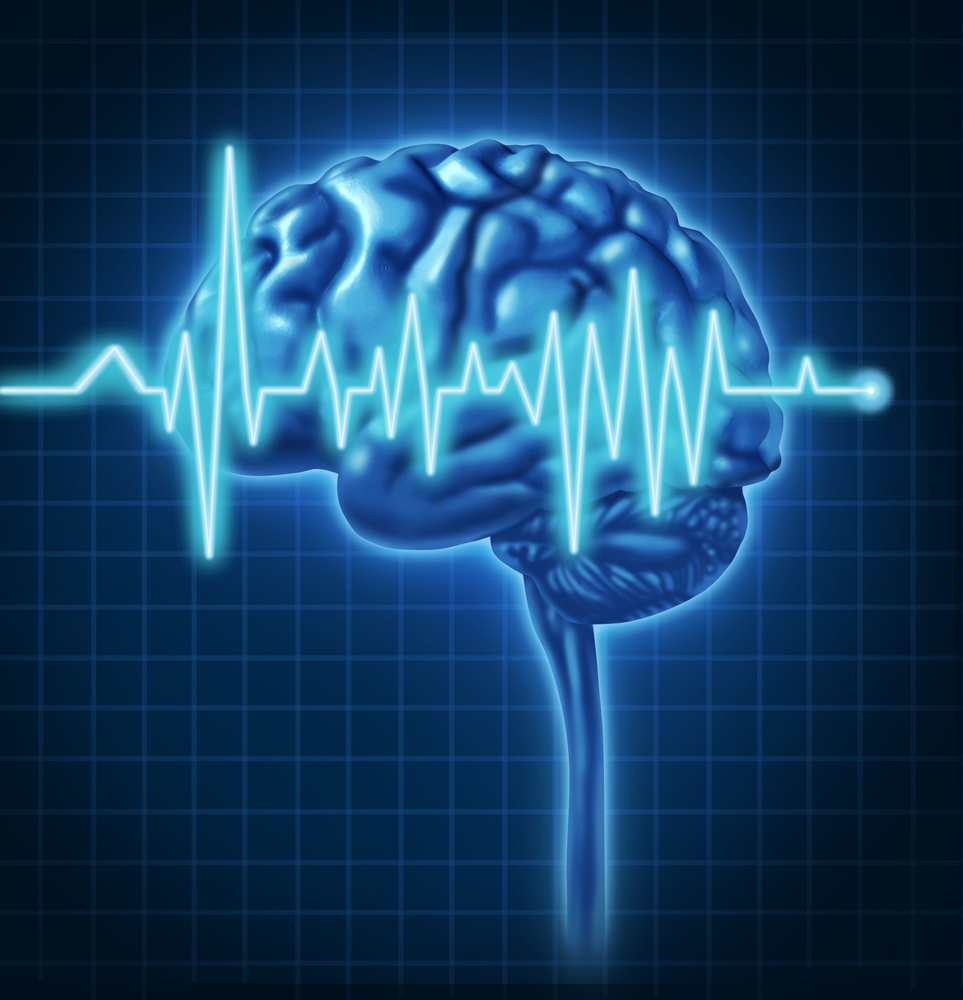 Study: Neurofeedback brain tra